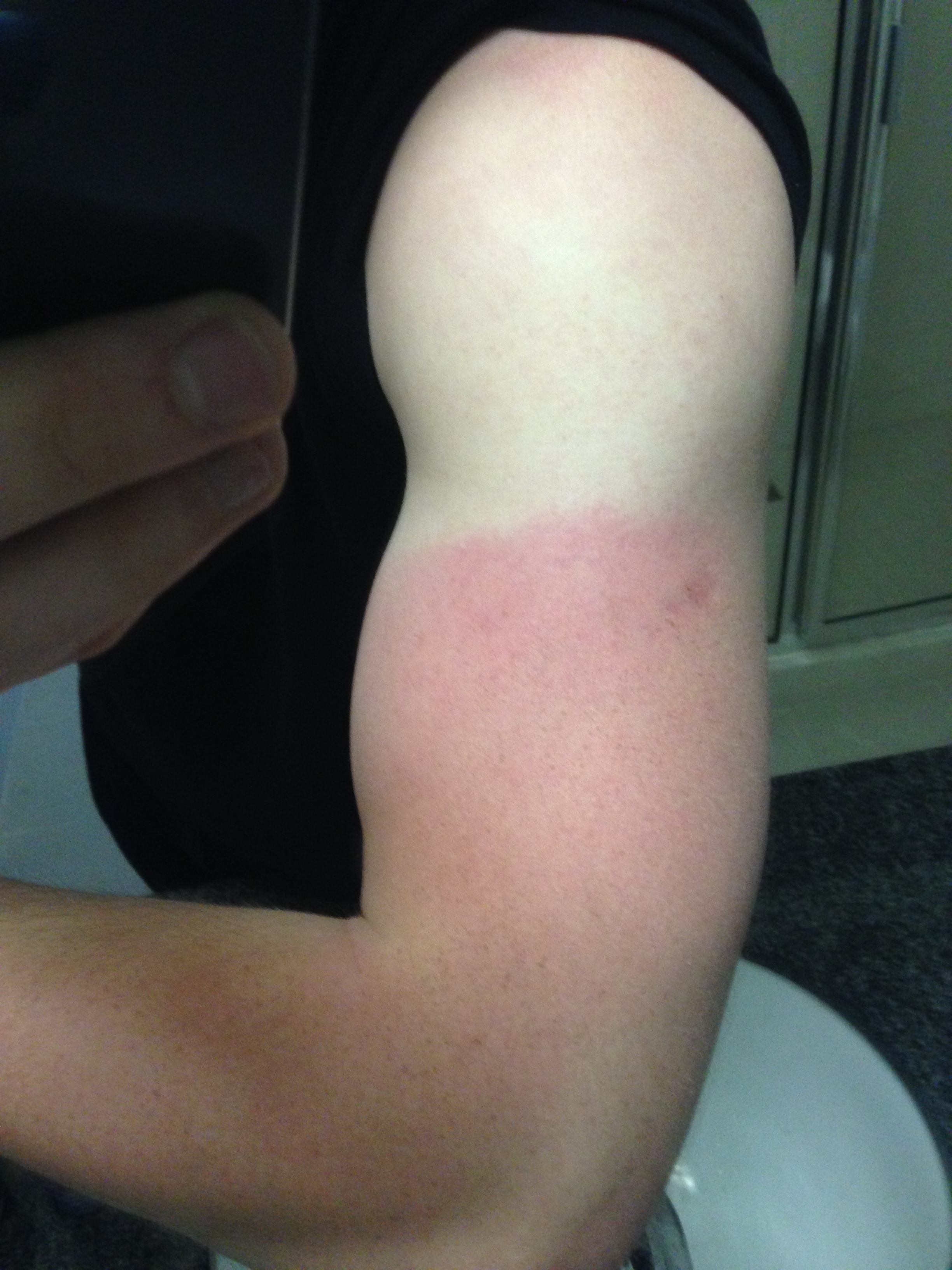 I actually got sunburn, having been sat on the roof of our building for an hour or so. It was January. This is odd to me.